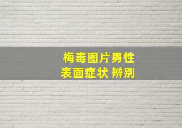 梅毒图片男性表面症状 辨别